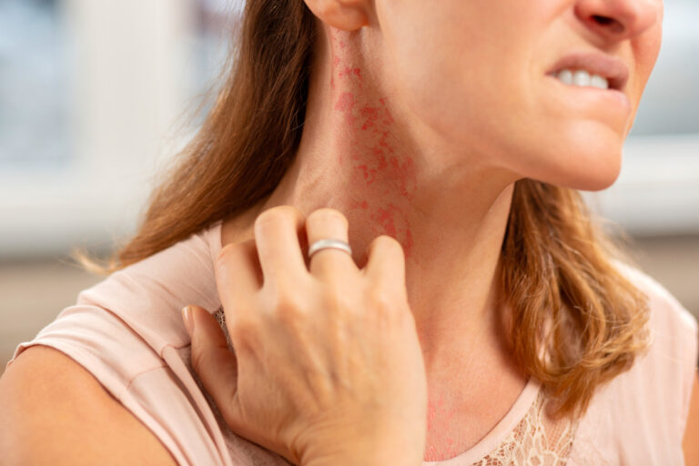 How Long Does An Allergy Take To Show?